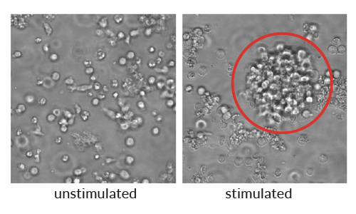 Activated morphology of human T Cells